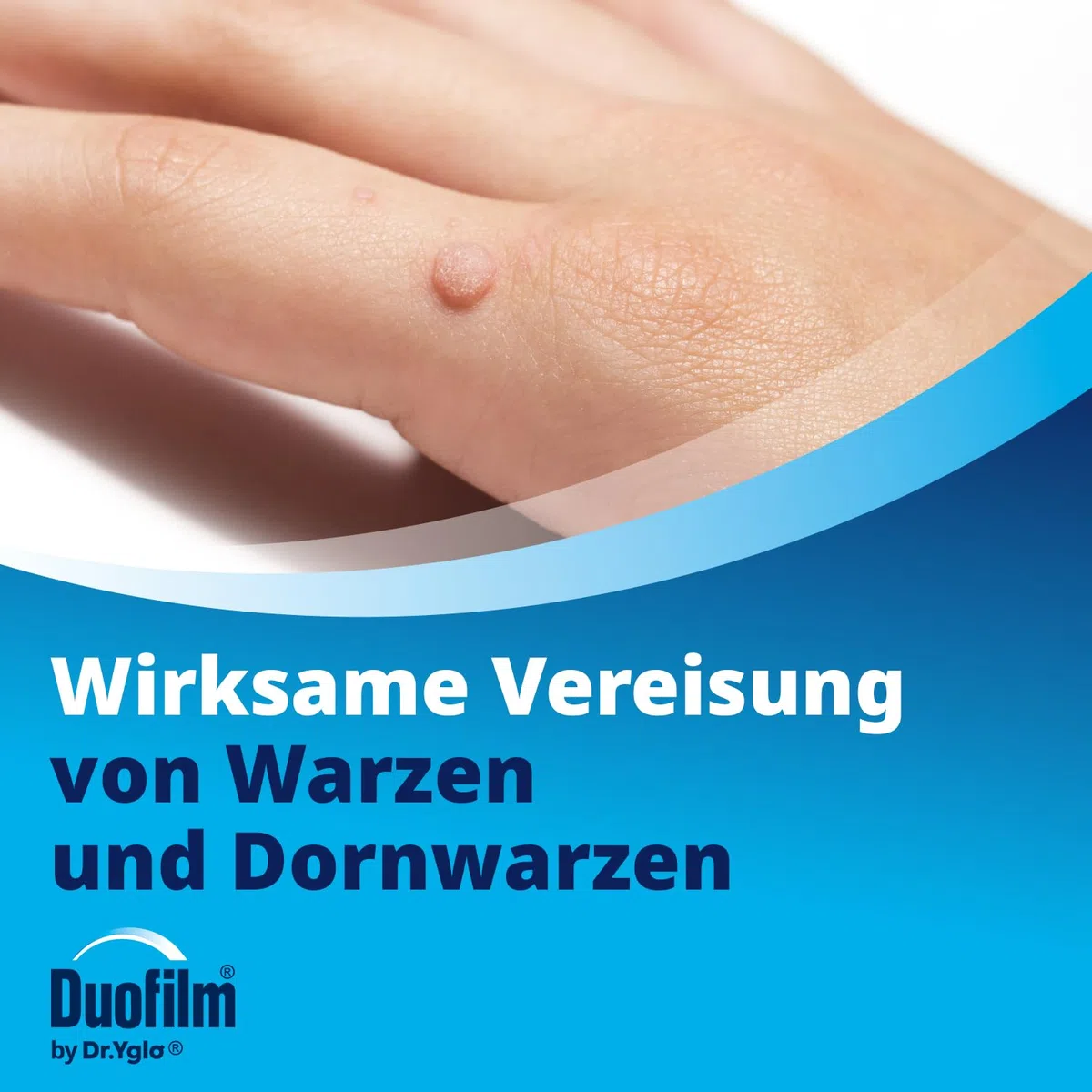 Duofilm Vereisungsspray by Dr Yglo gegen Warzen, Behandelt Warzen und Dornwarzen bei der ersten Anwendung, Wirksame Behandlung durch vereisen, Ab 4 Jahren, Medizinprodukt mit Dimethylether; 50 ml
